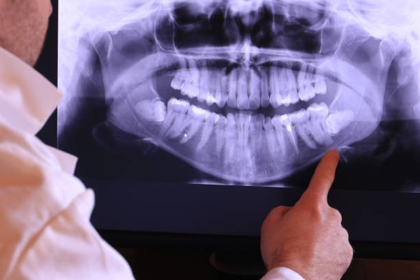 Best Emergency Treatment for Oral Infections in Roeland Park, KS