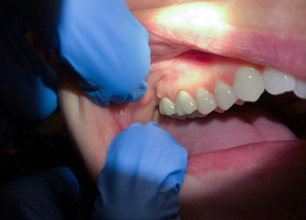 Best Walk-In Emergency Dental Services in Roeland Park, KS